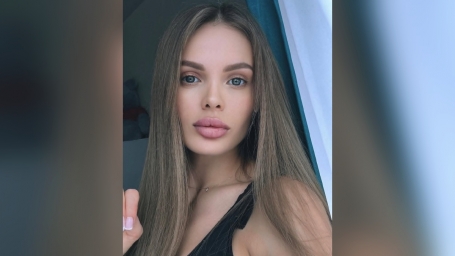 Перенесшая трепанацию черепа кубанская модель простила бывшего за свое избиение